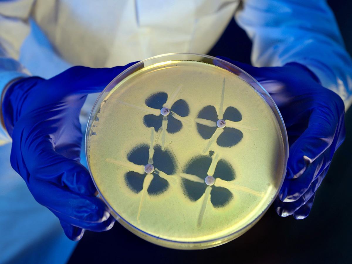 Bacteria that are resistant to carbapenems (Carbapenem-resistant Enterobacteriaceae (CRE)) produce a distinctive clover-leaf shaped growth pattern. Centers for Disease Control (CDC)
