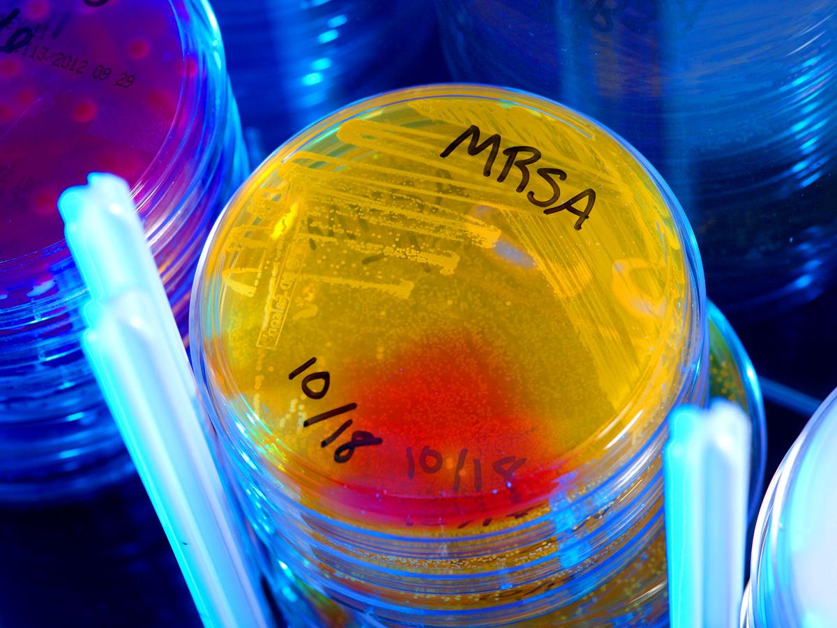 MRSA superbug - Centers for Disease Control and Prevention