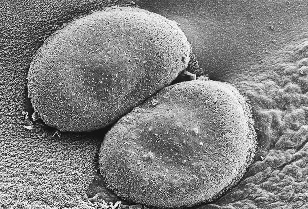 Streptococcus pneumoniae imaged with a scanning electron microscope. This bacteria is a major cause of pneumonia. When present in the nose or throat (its ‘ecological niche’) it benefits from the human body without harming it. Debbie Marshall, CC BY-SA